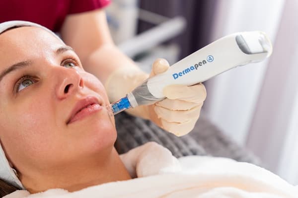 Dermapen 4